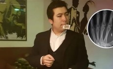 美国魔术师手掌植入芯片 但他忘记了密码