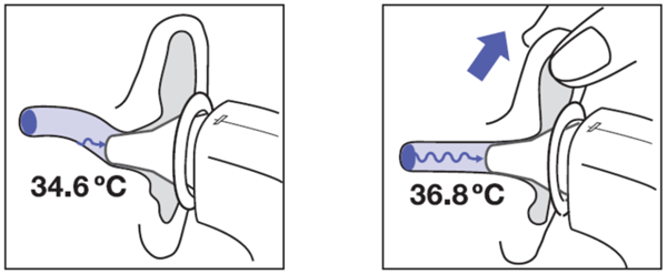 100多国联合封杀 水银体温计为什么非死不可