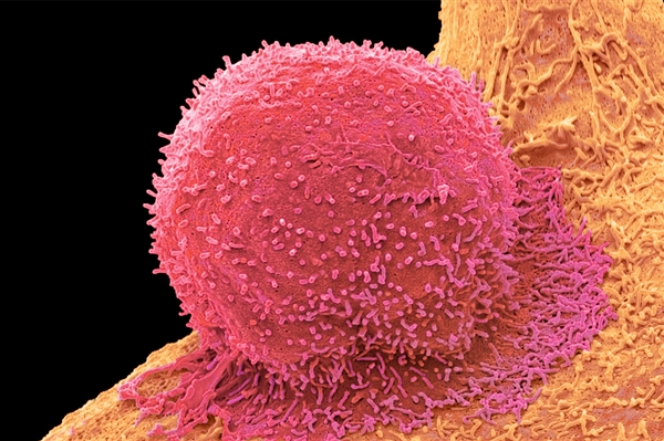 年轻人如何防癌 委员给出13字建议