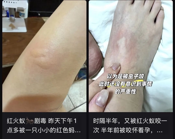 遇到这种小土包千万别踩！有可能丧命