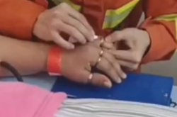 看着都疼！女子10根手指戴了10枚戒指 全部套牢卡死