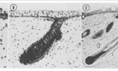 为什么每个人的头发都有“旋” 两个旋真的更聪明么