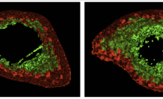 我国科学家在灵长类抗衰老研究新突破 有效逆转骨质疏松