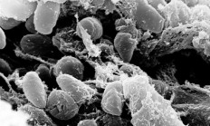 鼠疫耶尔森菌肆虐1500多年 曾杀死一半欧洲人！它靠改变一个基因 操纵人类命运