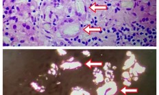 这种常见蔬菜吃多了 居然会引发严重急性肾损伤！