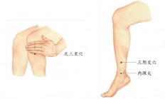 气胸常扰肺非真凶，原是痰湿在搞怪？