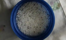 男孩把疏通剂当玩具 双手被灼伤差点不保