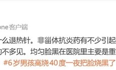 男孩发烧十几个小时：退烧后脸变黑