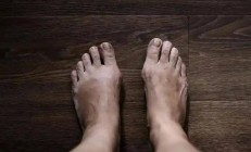 发现高血糖及时治疗，别等出现5类症状再去治，小心糖尿病足溃疡