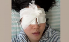 “右眼瞬间失明”！女游客高压水枪伤眼 如何应急处理