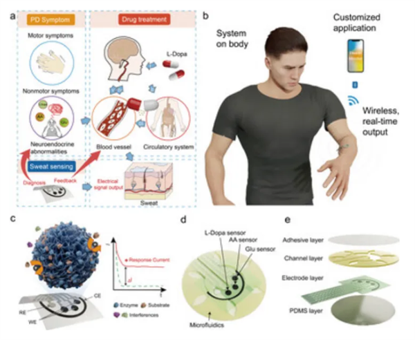 我国开发可穿戴监测系统:为帕金森病早期干预提供可能