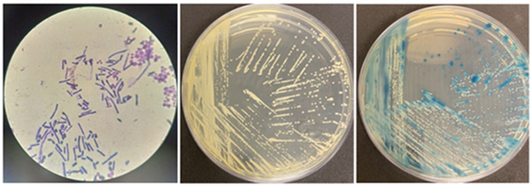 这种虫子 看到1只 你家里就有了1万只——不是蟑螂