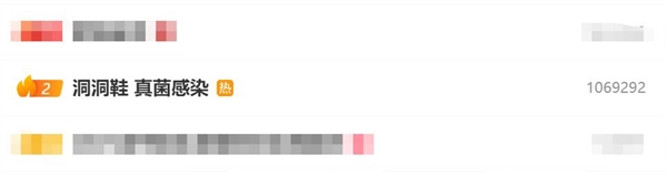 爱穿洞洞鞋的注意：可能会引发真菌感染