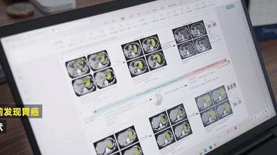 为了消灭癌症 他们把几千份遗憾喂给代码