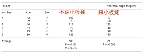 上厕所 坐着好还是蹲着好?最佳姿势竟然是……